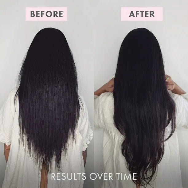 BondiBoost Hair Growth Conditioner, 300ml - Just Closeouts Canada Inc.